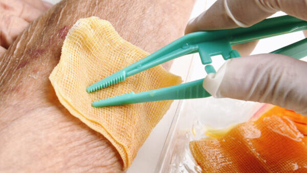 Cuidados de Feridas com Acompanhamento de Enfermeira