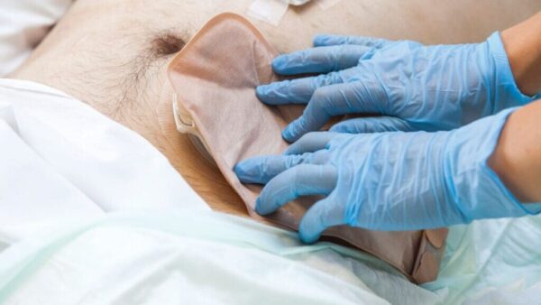O Papel dos Estomaterapeutas na Saúde e Bem-estar dos Pacientes