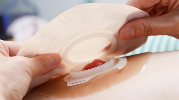 Tipos de estomas e suas funções